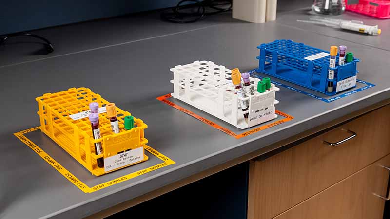 A counter displaying an organized setup of sample racks, each with clearly labeled sections following laboratory lean 5s best practices.